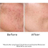 Super-G Youth Serum Mini