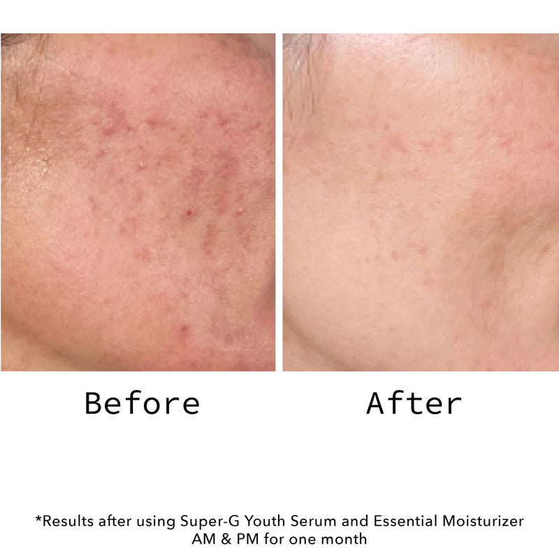 Super-G Youth Serum Mini