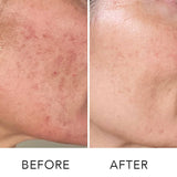 Super-G Youth Serum Mini