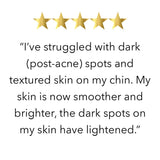 FIVE STAR REVIEW “I’ve struggled with dark (post-acne) spots and textured skin on my chin. My skin is now smoother and brighter, the dark spots on my skin have lightened.”